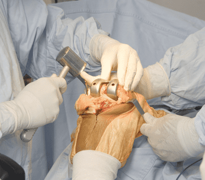 orthopaedic surgery